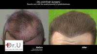 Dr U Hair & Skin Clinic image 6